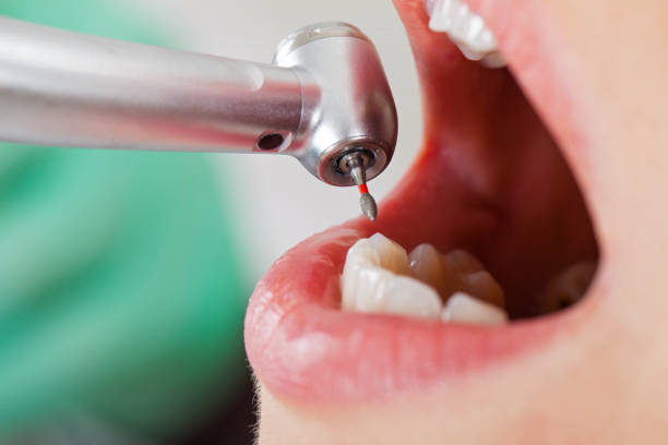 Best Broken Tooth Emergency  in Benson, MN